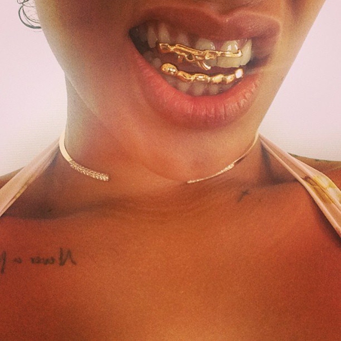 Самые дорогие апгрейды челюсти: бриллианты на зубах и прочие «извращения» (Канье Уэст, Кэти Перри, Рианна)