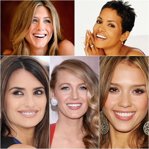 5 идеальных голливудских женских улыбок: Хэлли Берри, Блейк Лайвли, Джессика Альба, Дженнифер Энистон, Пенелопа Круз
